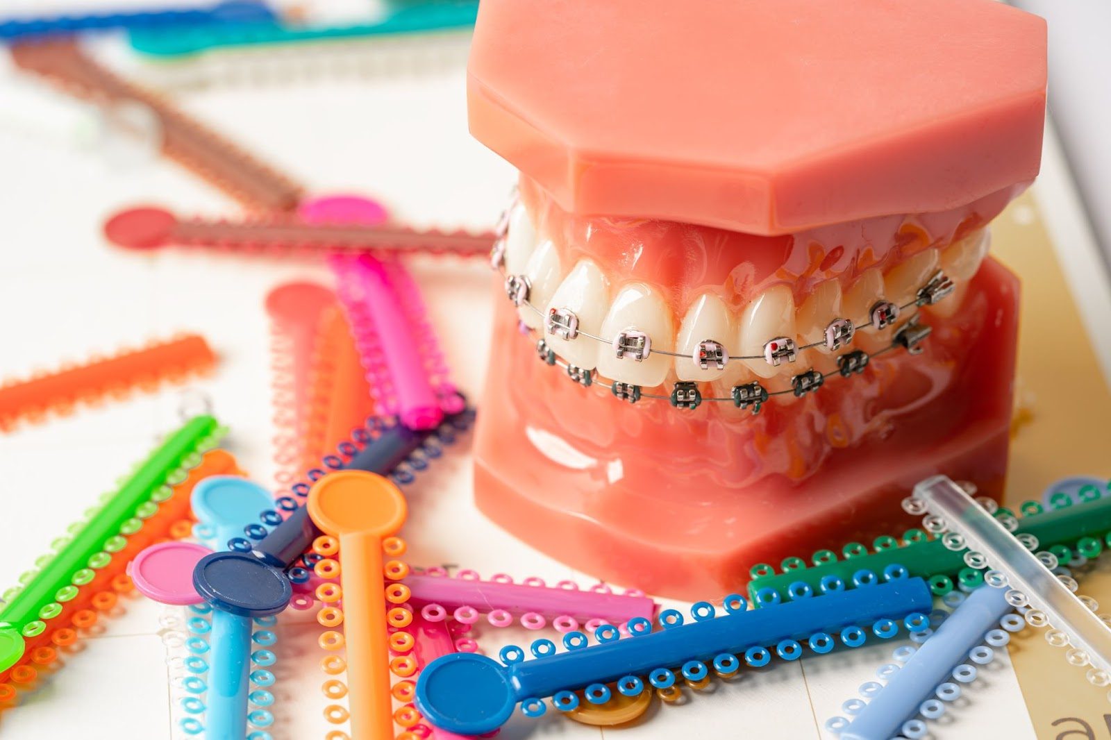 How Do Braces Work? Everything You Need To Know