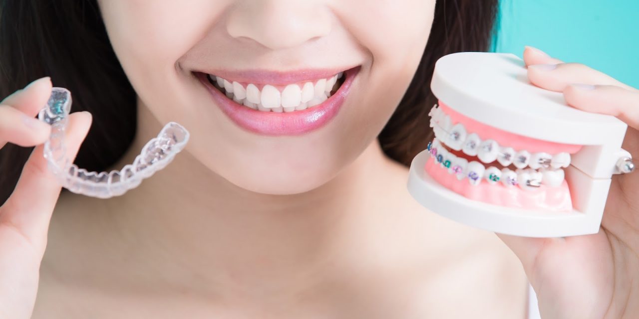 Are Traditional Braces Faster Than Invisalign