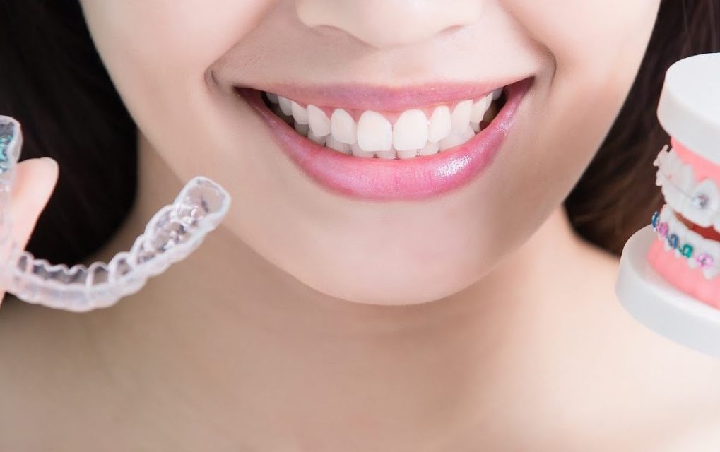 Are Traditional Braces Faster Than Invisalign