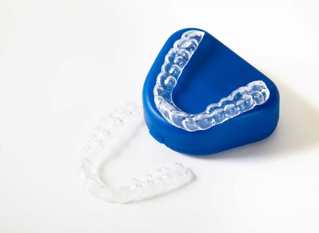 Invisalign Price Singapore - Why So Expensive?