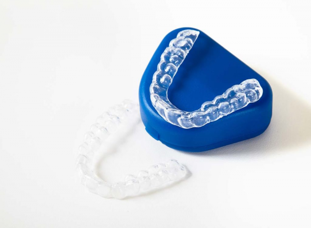 How to Reduce the Cost of Invisalign Treatment in Singapore