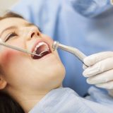 How To Take Care of Dental Fillings