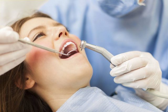 How To Take Care of Dental Fillings