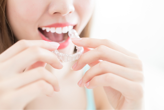 Invisalign Alternatives and Their Costs in Singapore