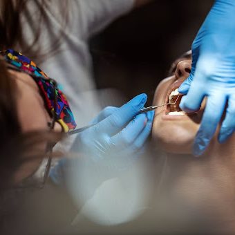 Tooth Extraction For Braces: Do You Need It?