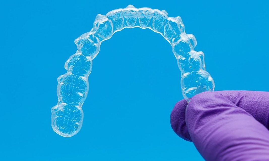 How Long Do You Really Need to Wear a Retainer
