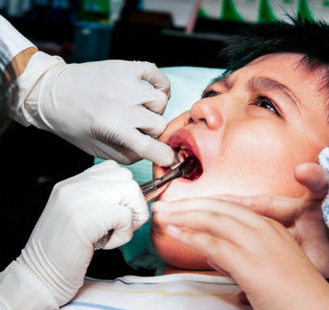 How to Help Children with Dental Anxiety