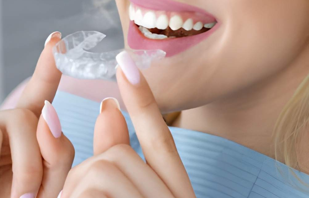 What Is the Difference Between Invisible Braces and Traditional Braces in Singapore?