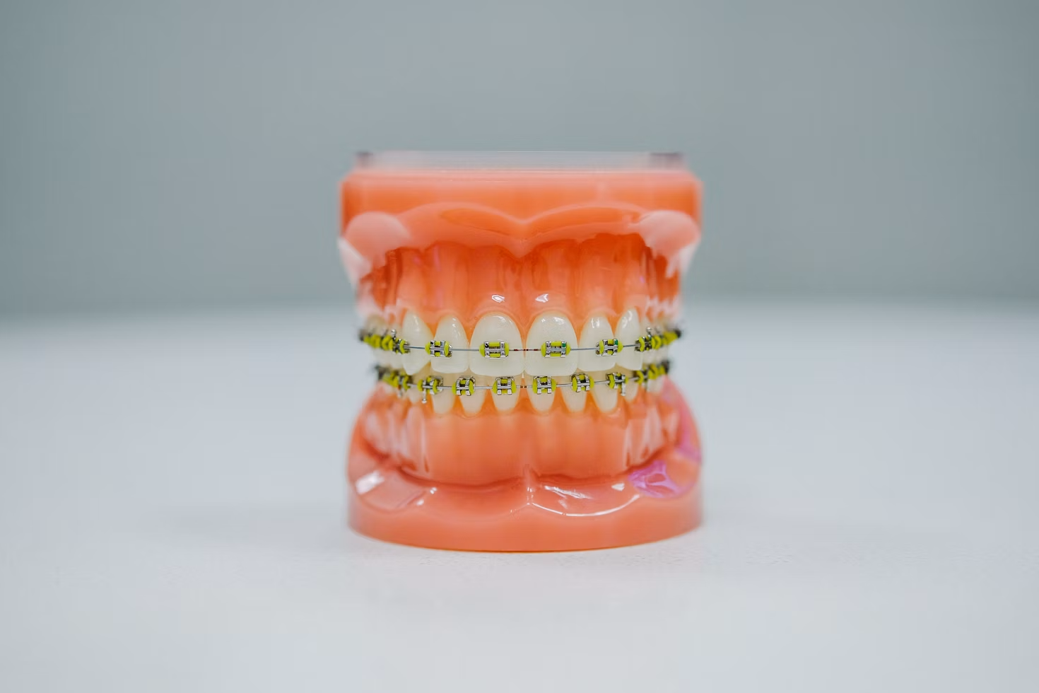why should malocclusion be treated