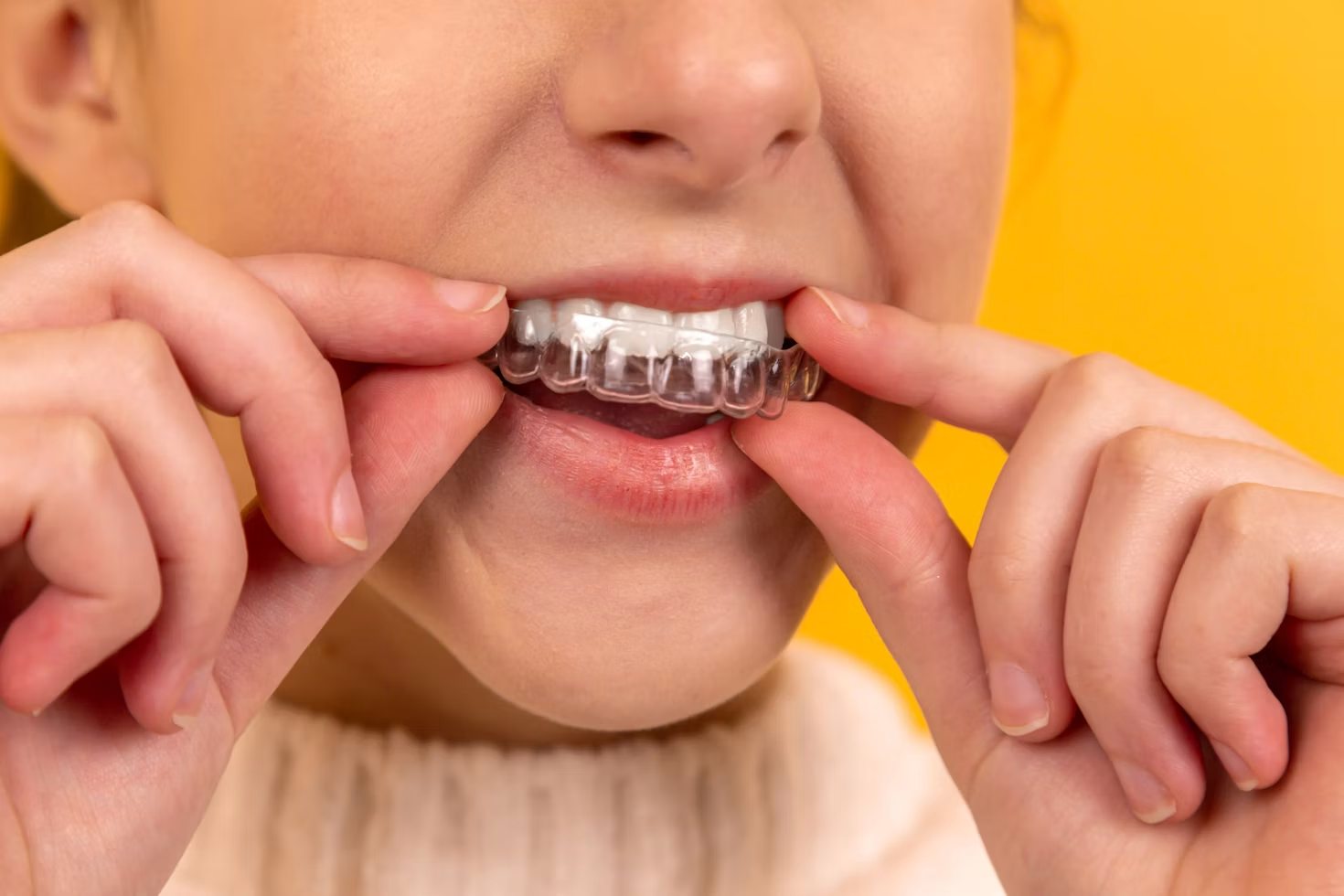 How Do Metal Braces Compare With Other Orthodontic Options?